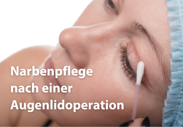 Meine fünf Tipps zur Narbenbehandlung nach Oberlidstraffung 